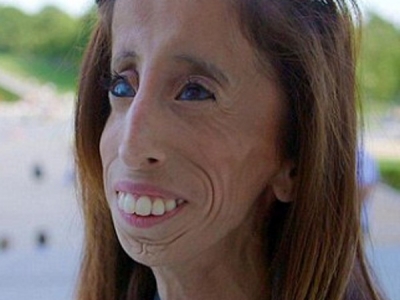 01这名来自美国的26岁女孩丽兹·维拉斯奎兹被称为世界上最丑的女人