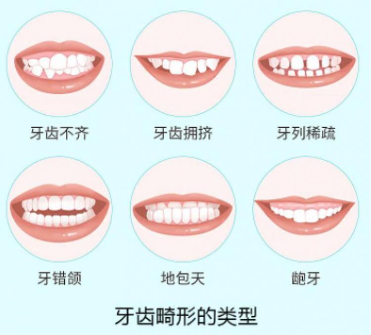 牙齿正畸需要注意什么内容？