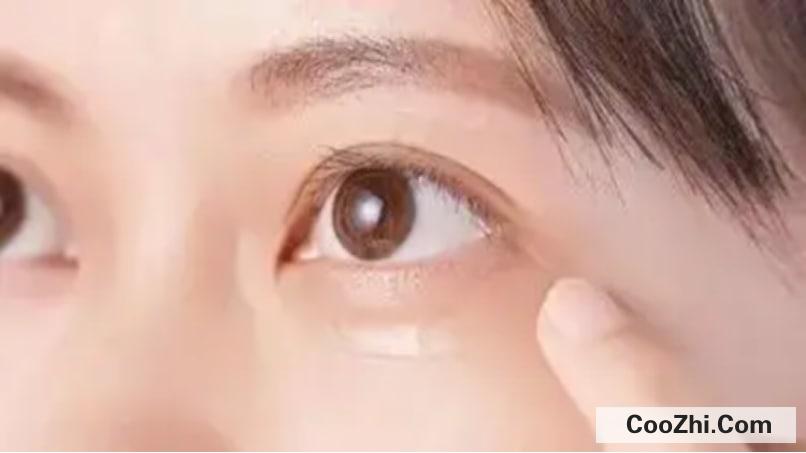 如何改善眼周细纹？