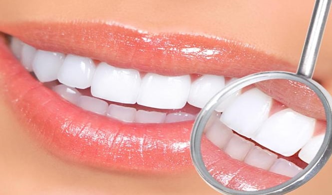 牙齿美白的方法都有哪些