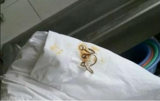 衣服上的铁锈怎么洗
