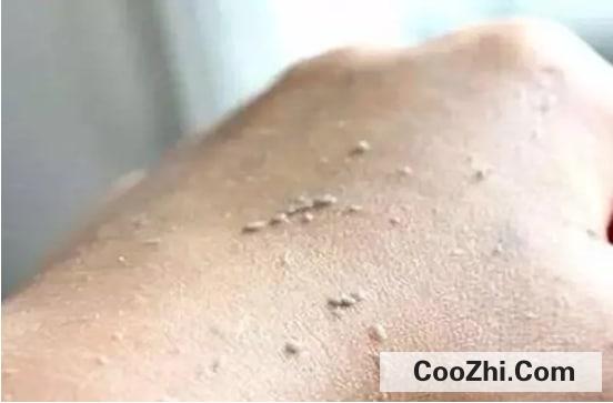 为什么天天洗澡，身体还是会搓出泥呢