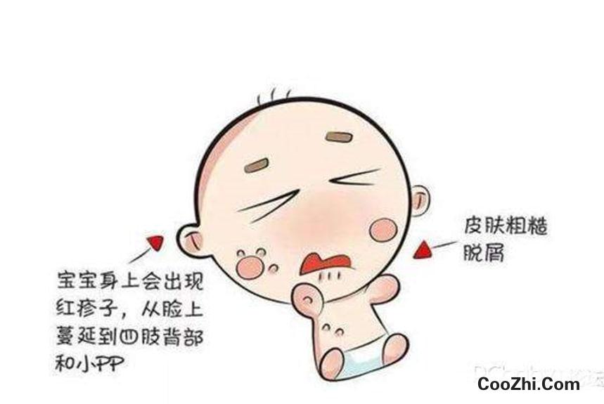 新生儿湿疹怎么办