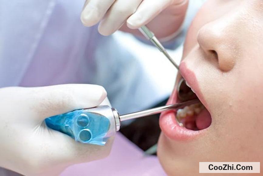洗牙后牙龈多久能恢复