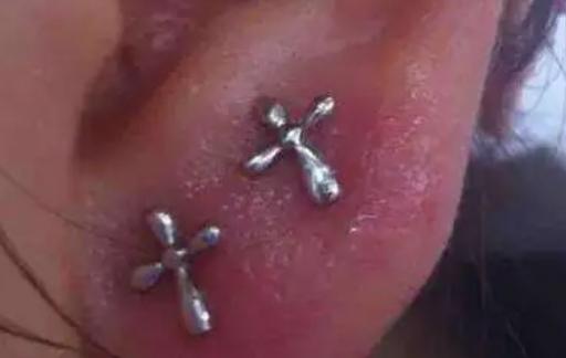 耳洞老是发炎该咋处理
