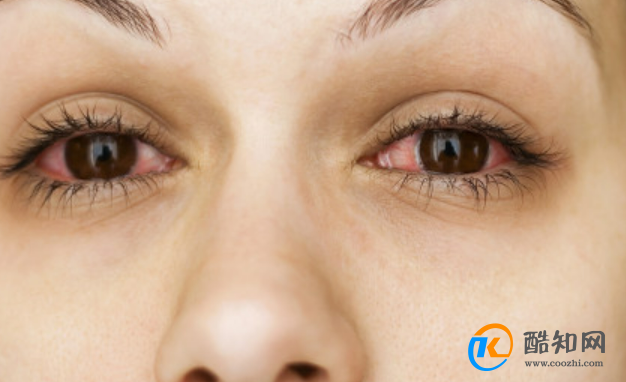 眼角痒是什么病的前兆