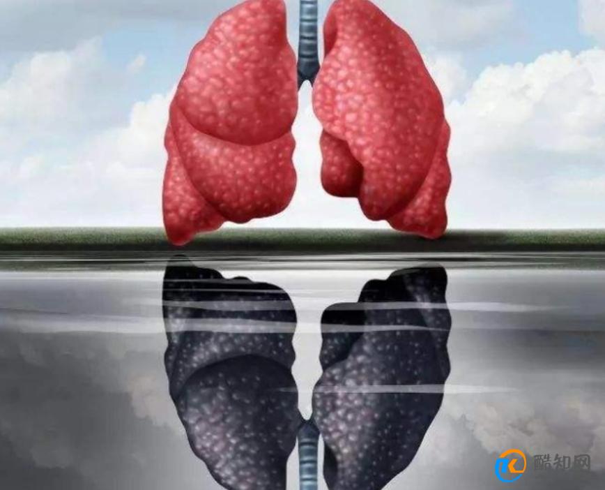 肺部有病，喉咙先知？如果喉咙出现这2个症状，应及时去医院检查