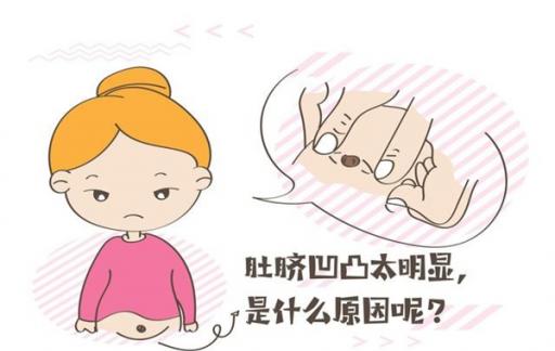 怀孕之后  肚脐是“凹”还是“凸”  背后寓意很重要