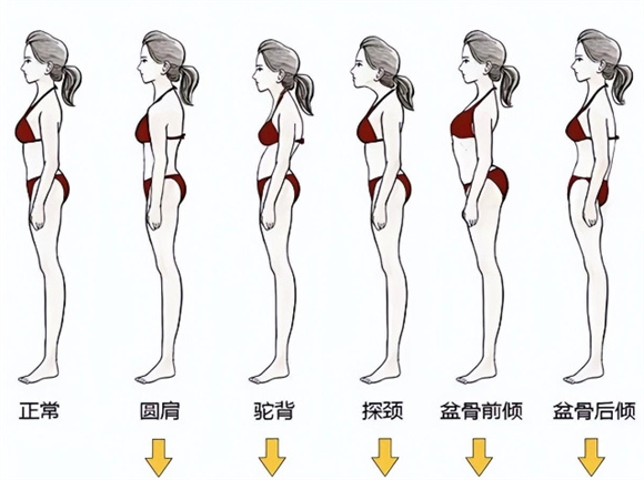“体态”对女生气质影响有多大？看完这3组对比图后，你就明白了