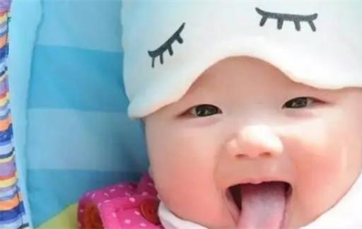 婴儿舌苔厚白是怎么回事 二个月婴儿舌苔厚白有必要去掉吗