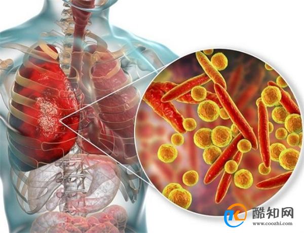 预防支原体肺炎的方法有什么